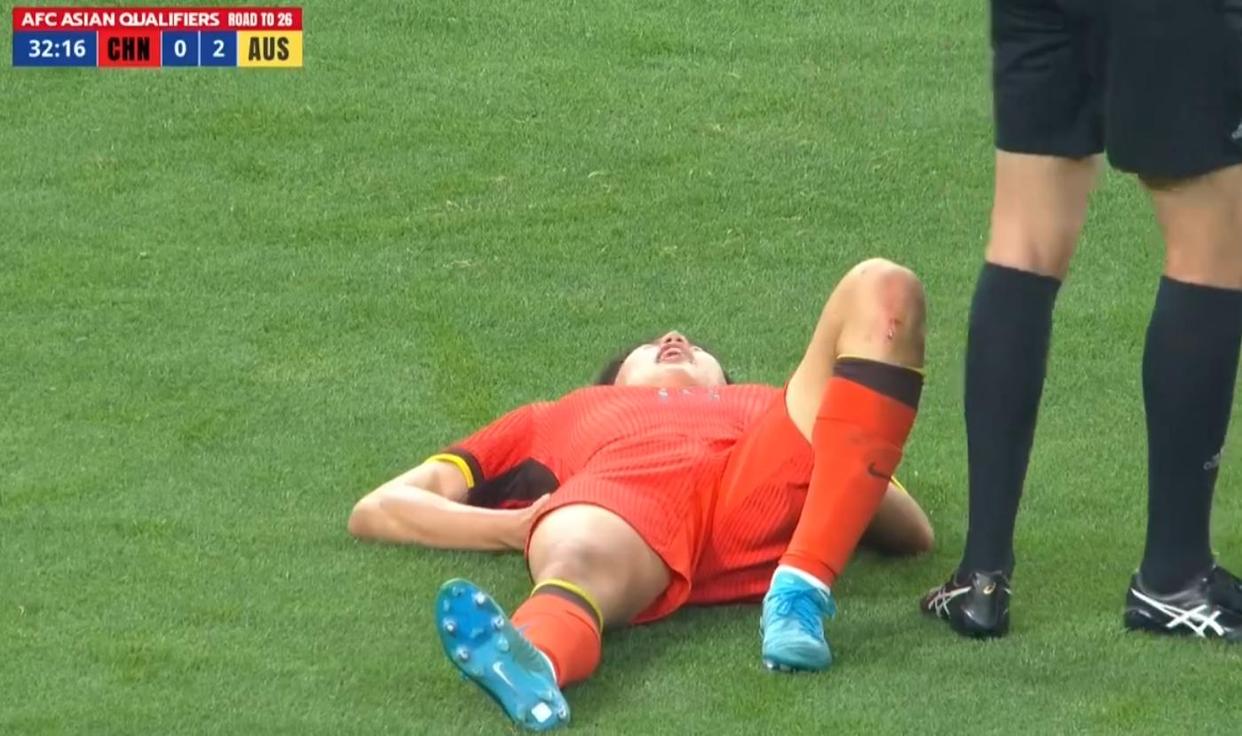 一线队球员因伤缺席下一场比赛，教练组神秘安排曝光的简单介绍